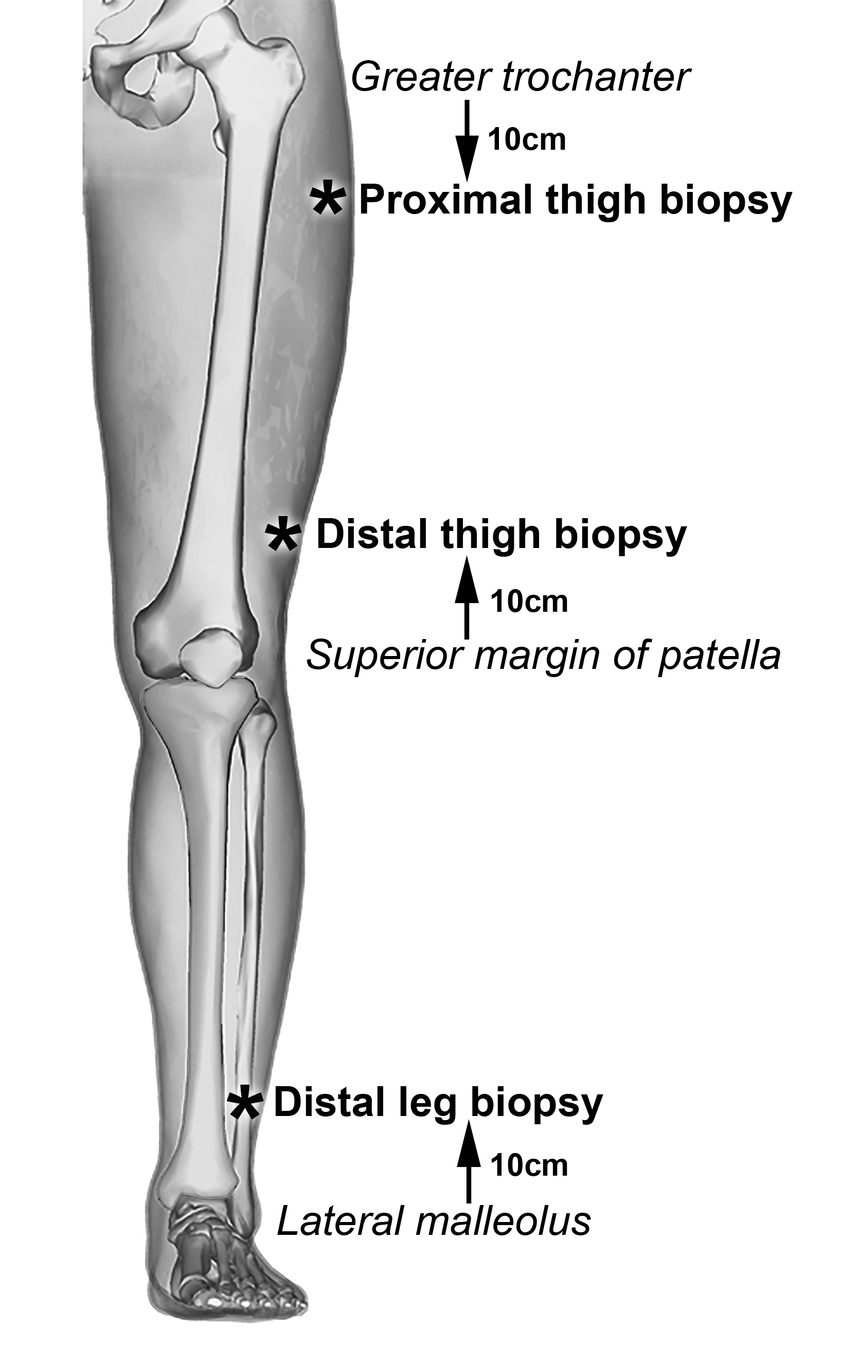 Anatomic Sites on Leg