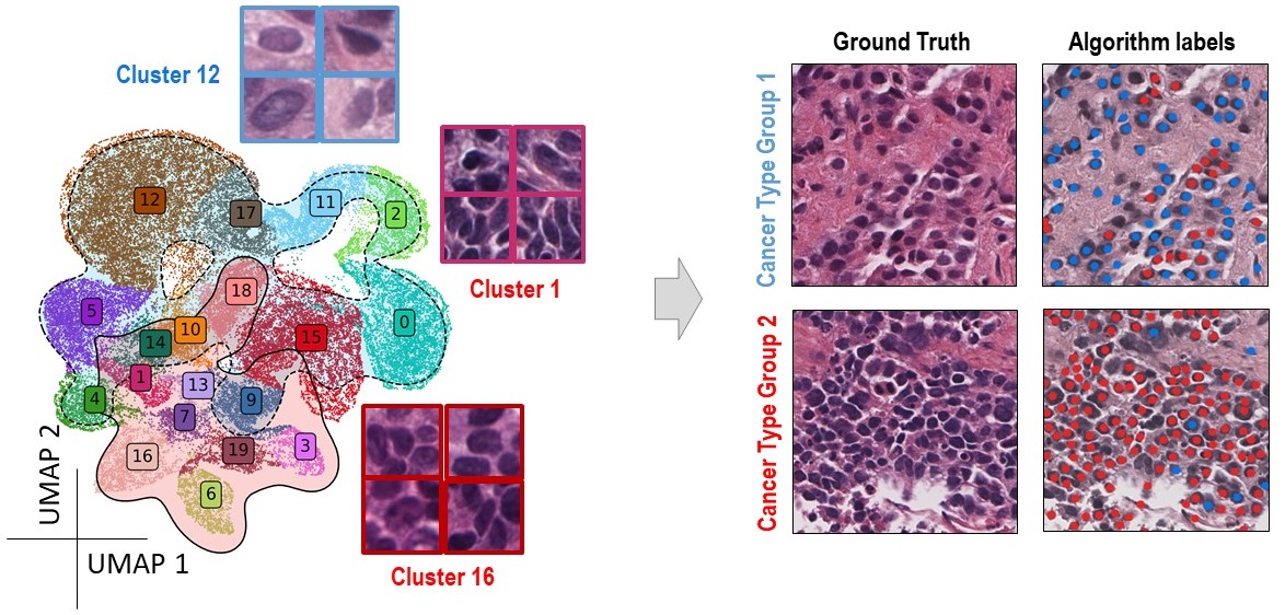 Nuclear Segmentation