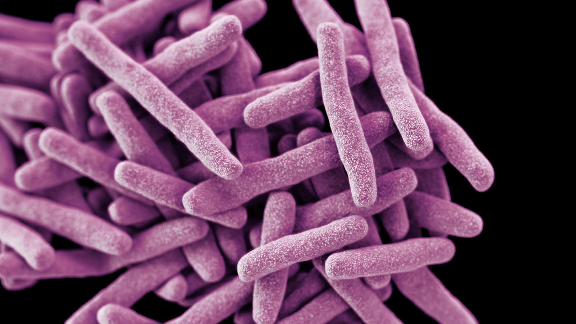 Drug-resistant tuberculosis Centers for Disease Control and Prevention