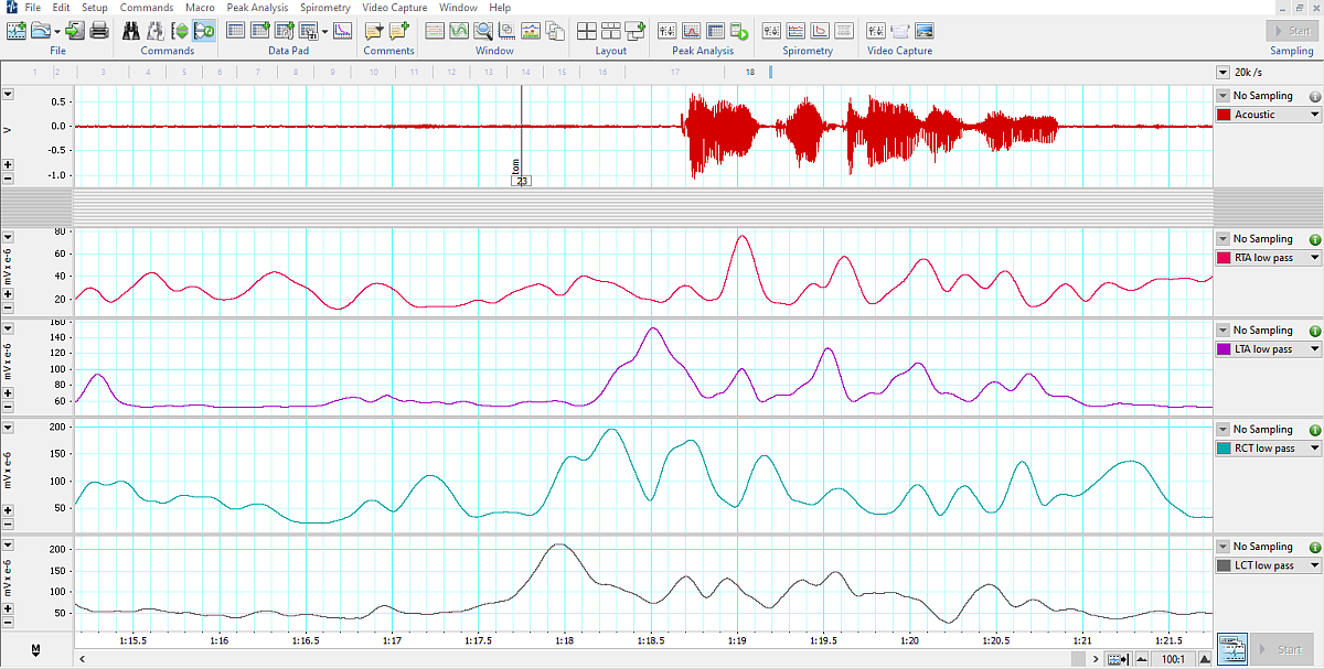 Labchart