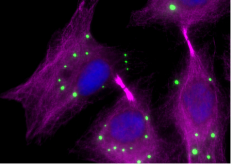 Abscission checkpoint bodies (ACBs, green) in dividing cells in which errors have been detected. Cell nuclei are shown in blue, and sites of arrested cell separation are marked by microtubules (magenta).