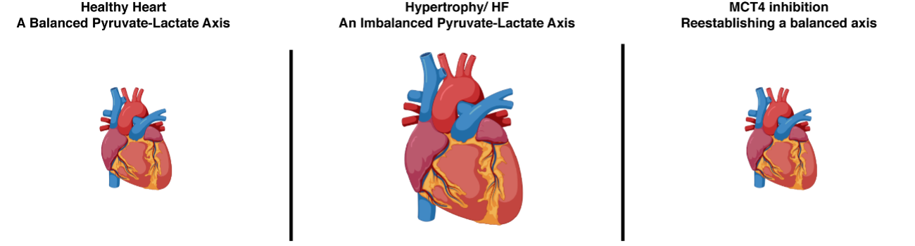 The metabolic rewiring of cardiomyocytes is a widely accepted hallmark of heart failure and hypertropy. In models of heart failure,  metabolism is rewired toward lactate production and secretion through decreased myocardial expression of the mitochondrial pyruvate carrier (MPC), leading to cardiac hypertrophy (middle panel). Recovery could be induced by treatment with a potent inhibitor of the Monocarboxylate Trasporter 4 (MCT4) (right panel).