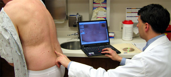 dermatology mole screening
