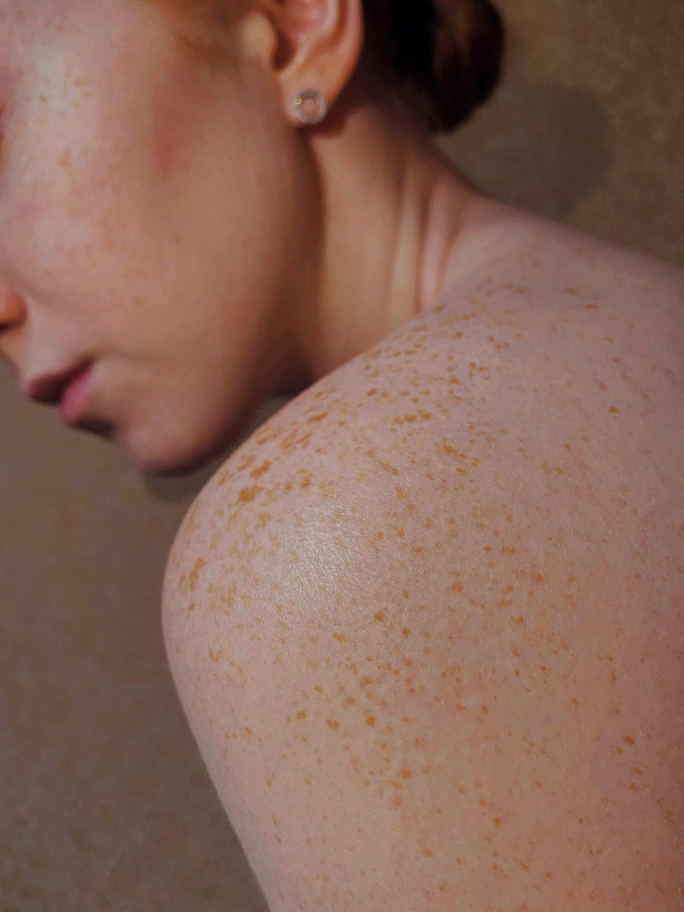 Patient Skin