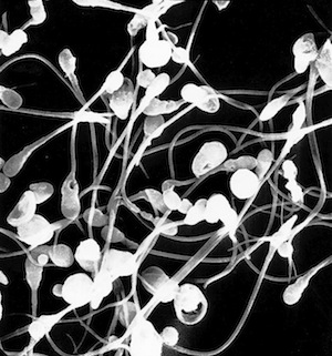 Scanning electron micrograph of numerous sperm morphologies.