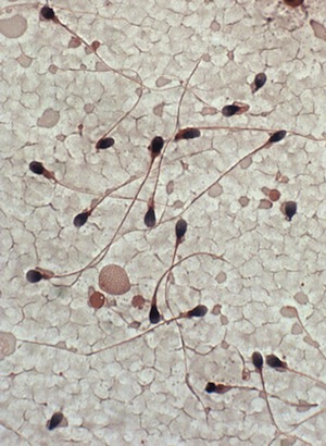 Light photomicrograph of human sperm cells