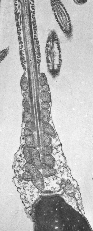 Transmission Electron Micrograph (TEM) of the sperm midpiece