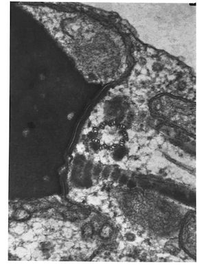 Transmission Electron Micrograph (TEM) of the sperm centrosome