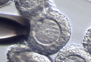 Small germinal vesicle stage mouse oocyte