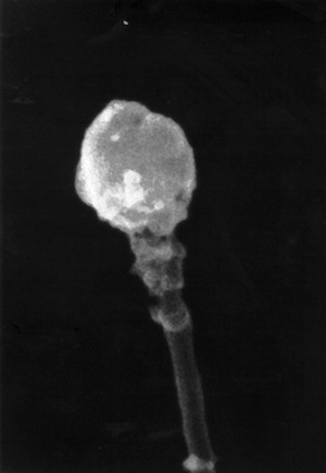Scanning electron micrograph (SEM) of a round-headed sperm cell
