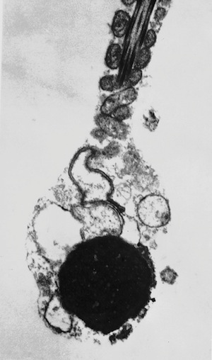 Transmission electron micrograph (TEM) of a round-headed sperm