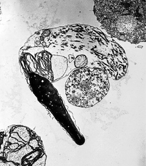 Transmission electron micrograph (TEM) of an abnormal sperm