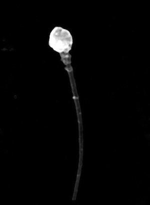 Scanning electron micrograph of a round-headed sperm.