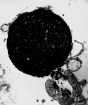 Abnormal head and midpiece morphology of a round-headed sperm lacking an acrosome.