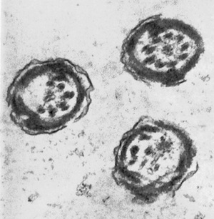 Transmission electron micrograph of cross sections of tails from three sperm