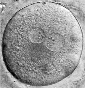 Fertilized human oocyte. Note the normal segregation of the nucleoli towards the center of the two pronuclei.