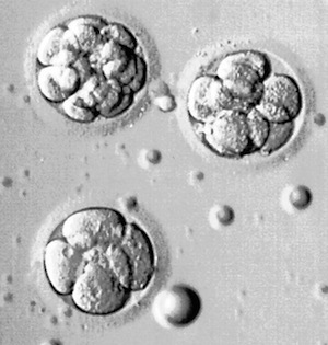 Three human embryos ready for transfer to the recipient. The embryos are 6, 8, and 10 cells, respectively.