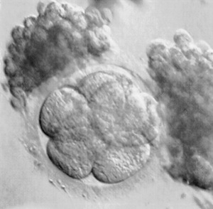 Human embryo with attached cumulus tissue.