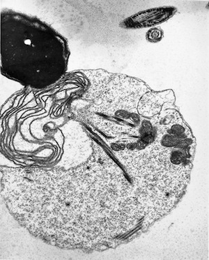 Transmission electron micrograph (TEM) of a sperm