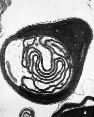 Abnormal sperm head morphology revealed by transmission electron microscopy (TEM)