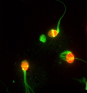 Fluorescent micrograph of sperm stained with propidium iodide red and PSA green