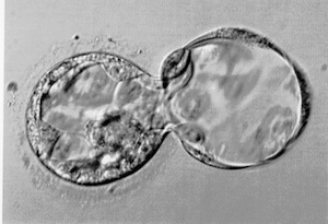 human blastocyst