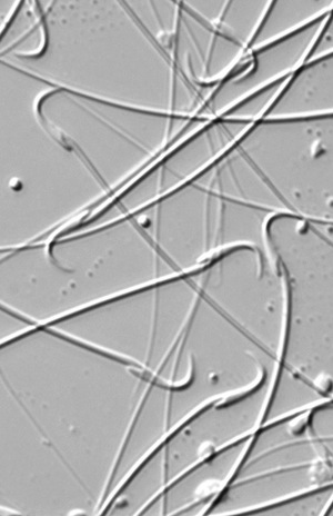 Light photomicrograph of live rat sperm
