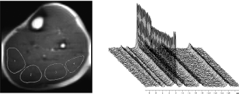 Magnetic Resonance