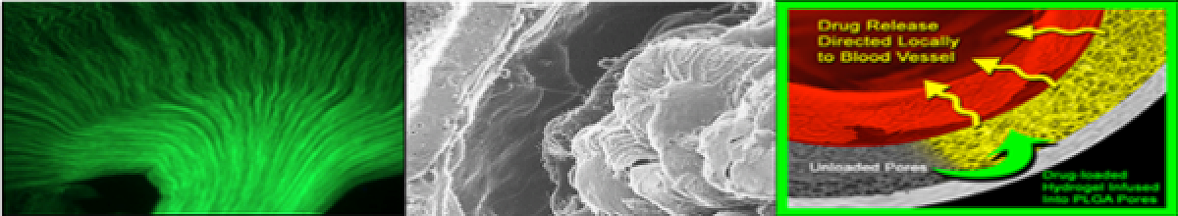 nephrology research images