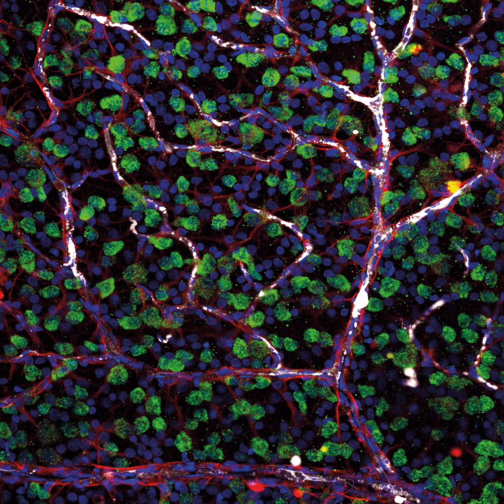Retinal ganglion cells (green) connecting with astrocytes (red) and blood cells (white) in the inner retina.