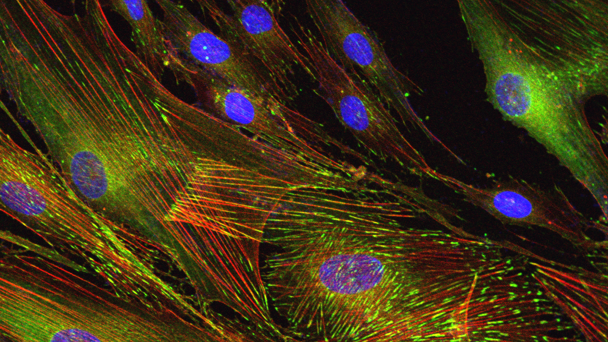 Krizaj Lab Trabecular Meshwork Cells Imaging