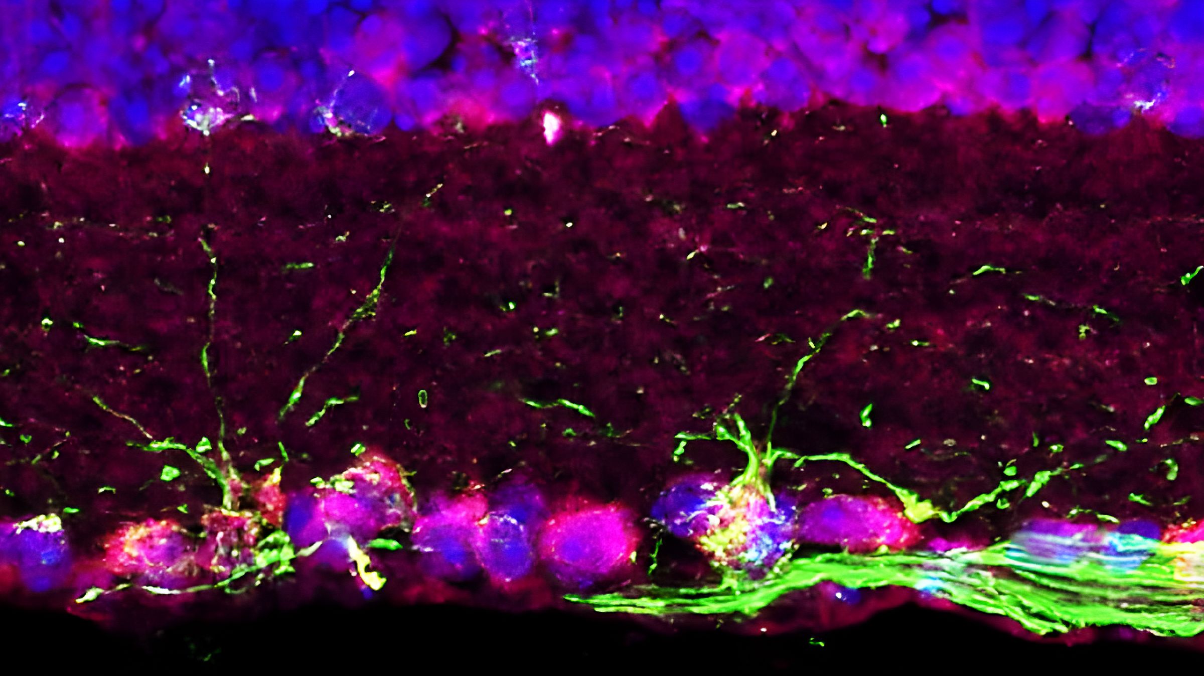 Microscopy and color labeling of retinal ganglion cells (RGCs), the cells that form the optic nerve and are damaged by glaucoma.