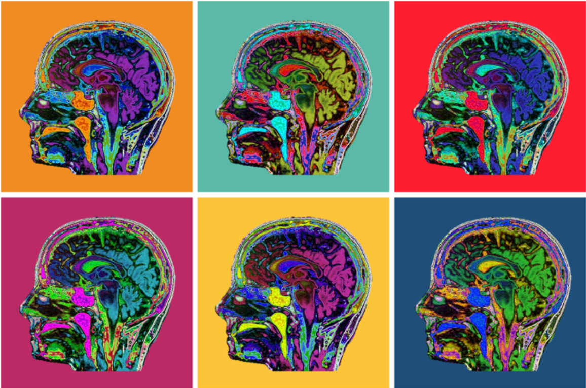 Colorful brain images