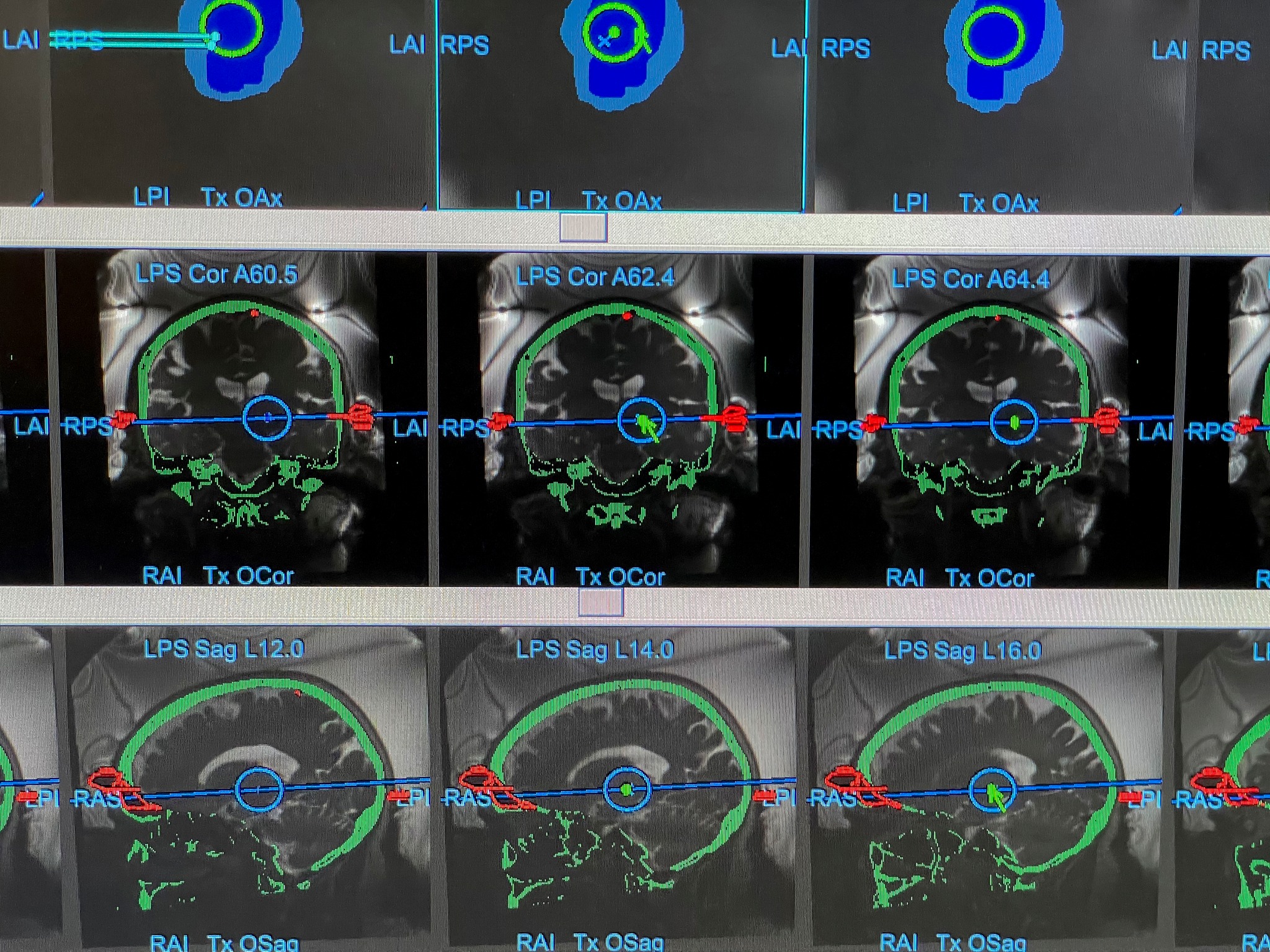 Brain Imaging from FUS Team