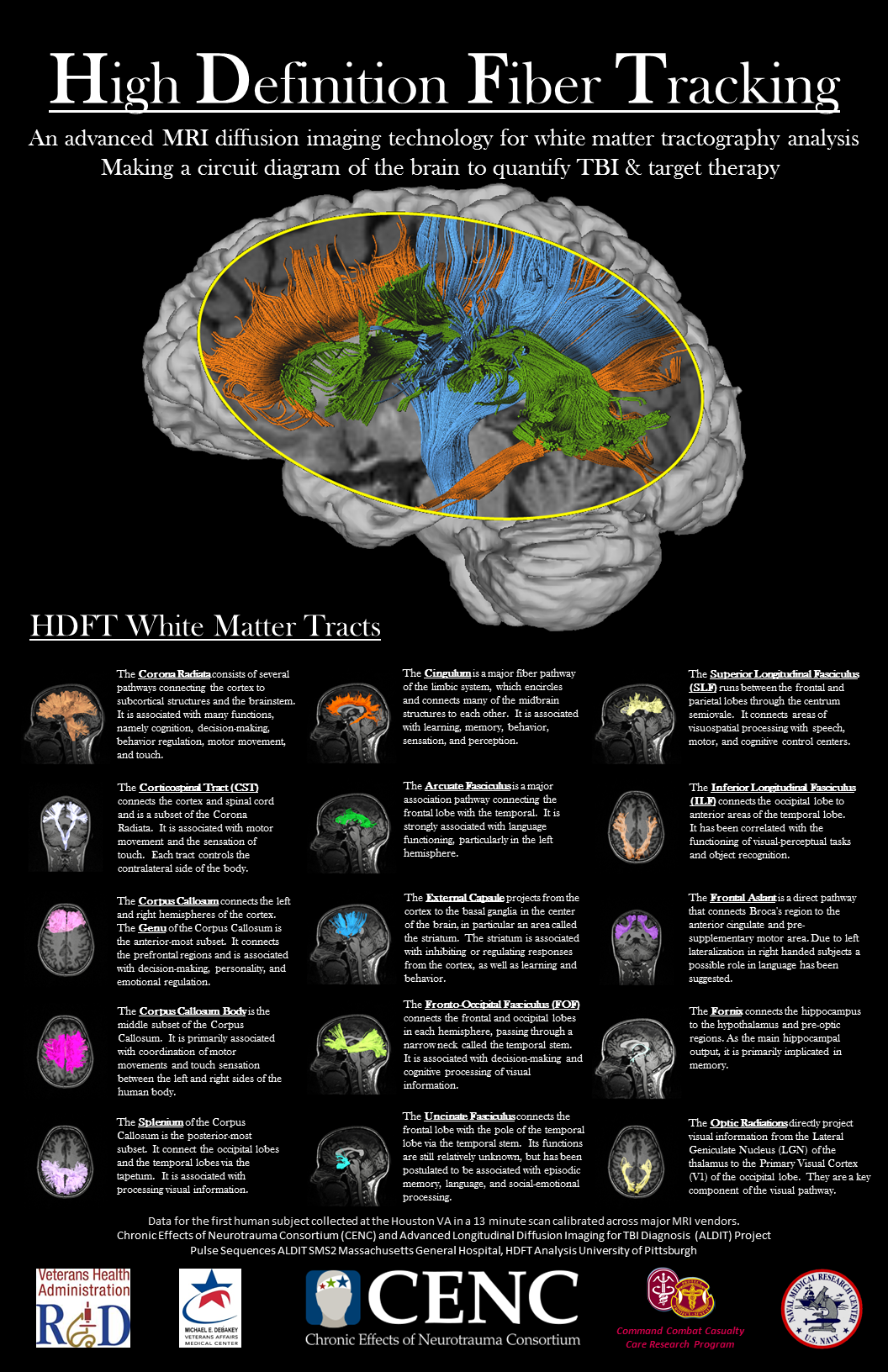 HDFT Poster
