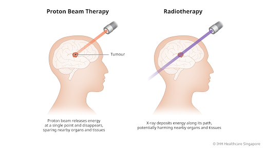 Proton Beam Therapy image