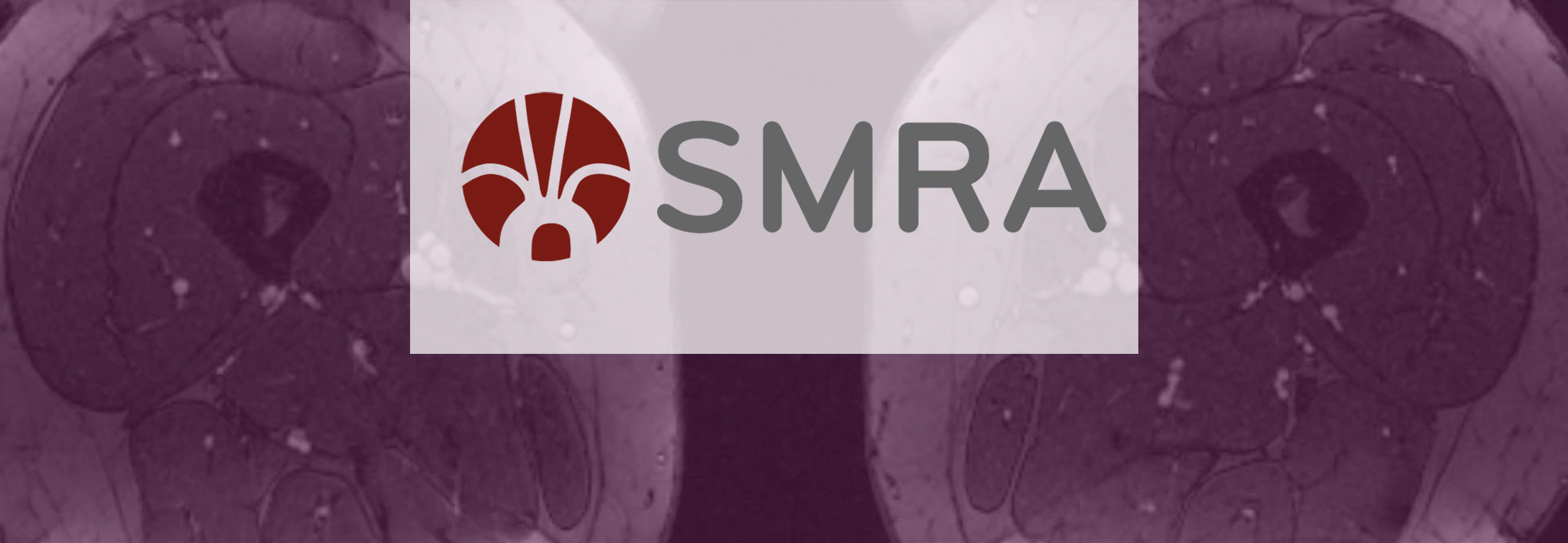 SMRA image