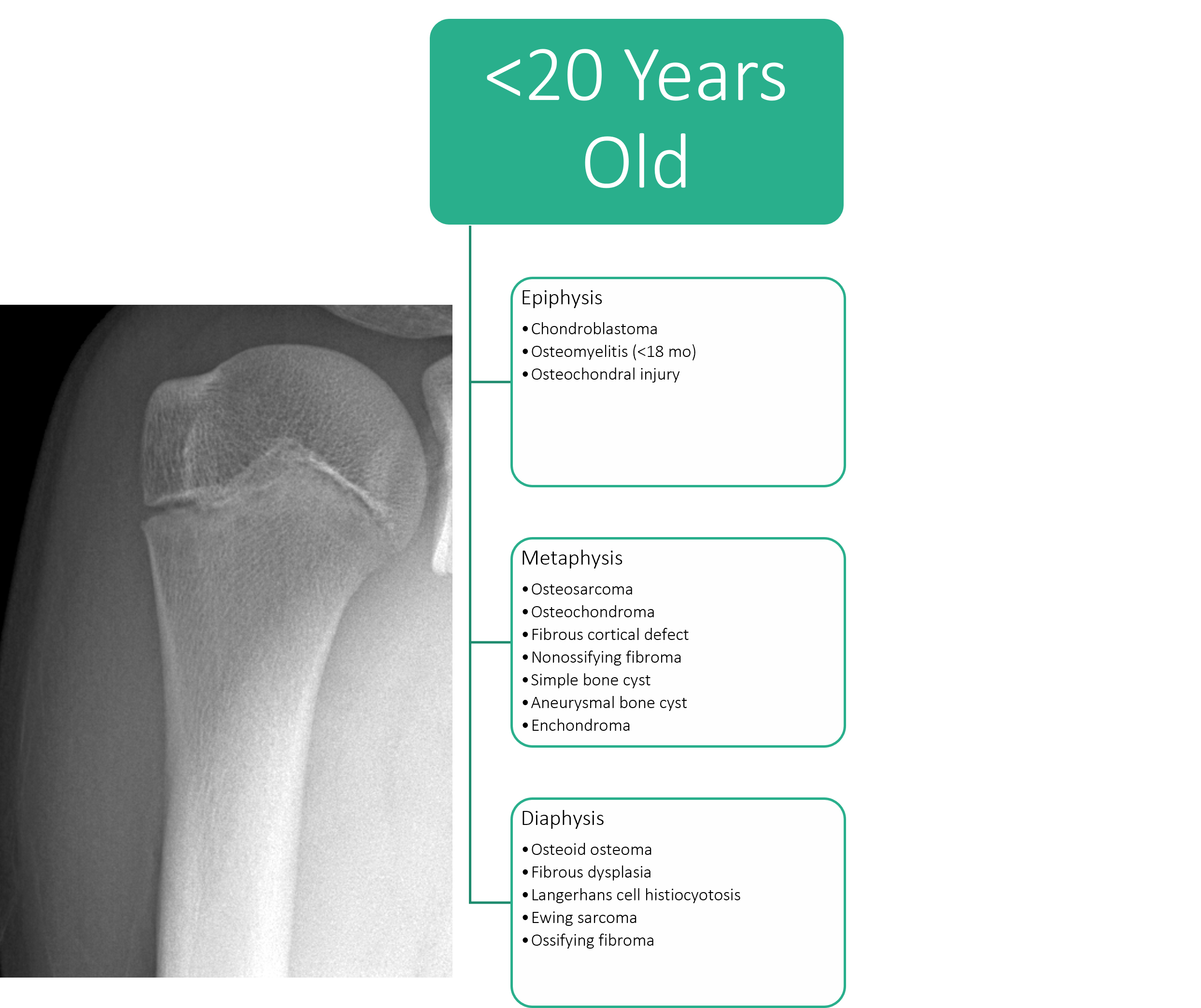 Tumor Bone Lesion 2