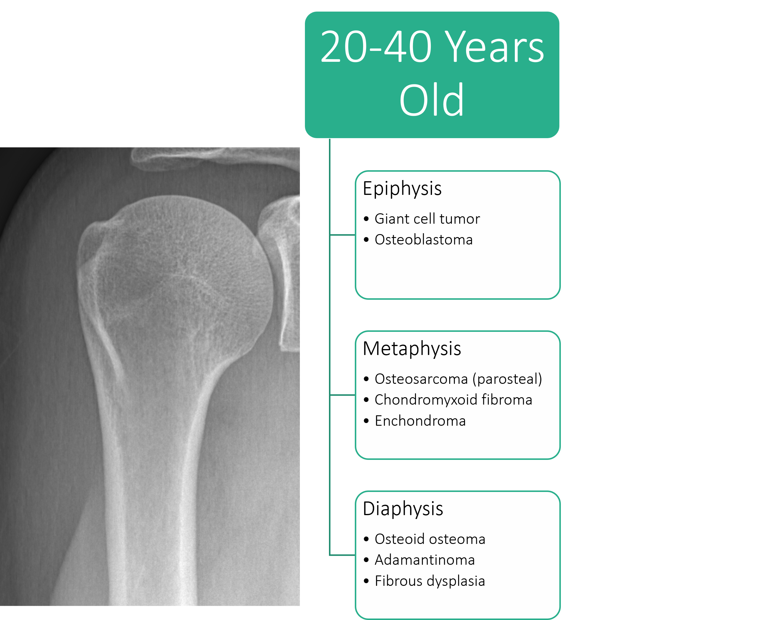 Tumor Bone Lesion 3