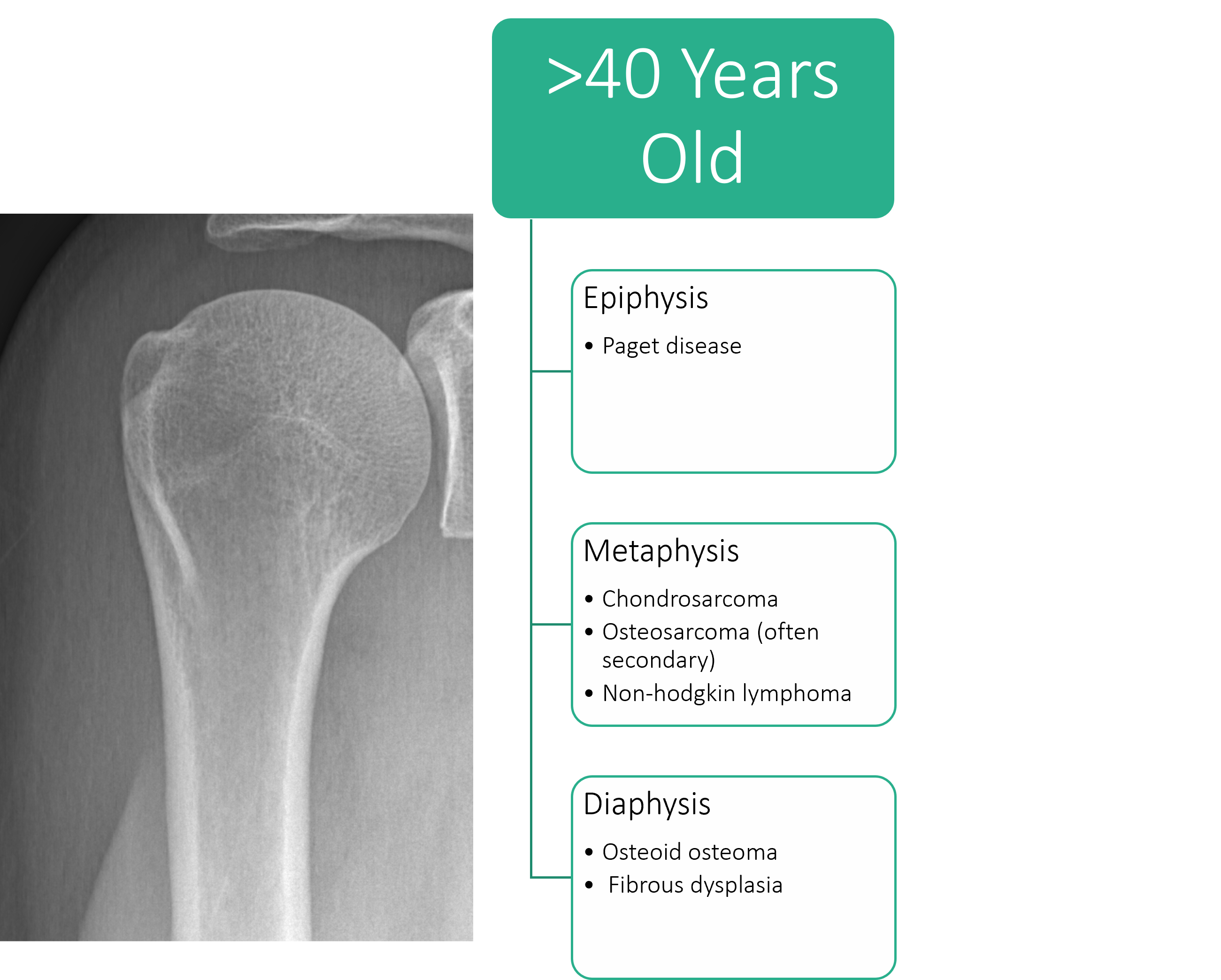 Tumor Bone Lesion 4