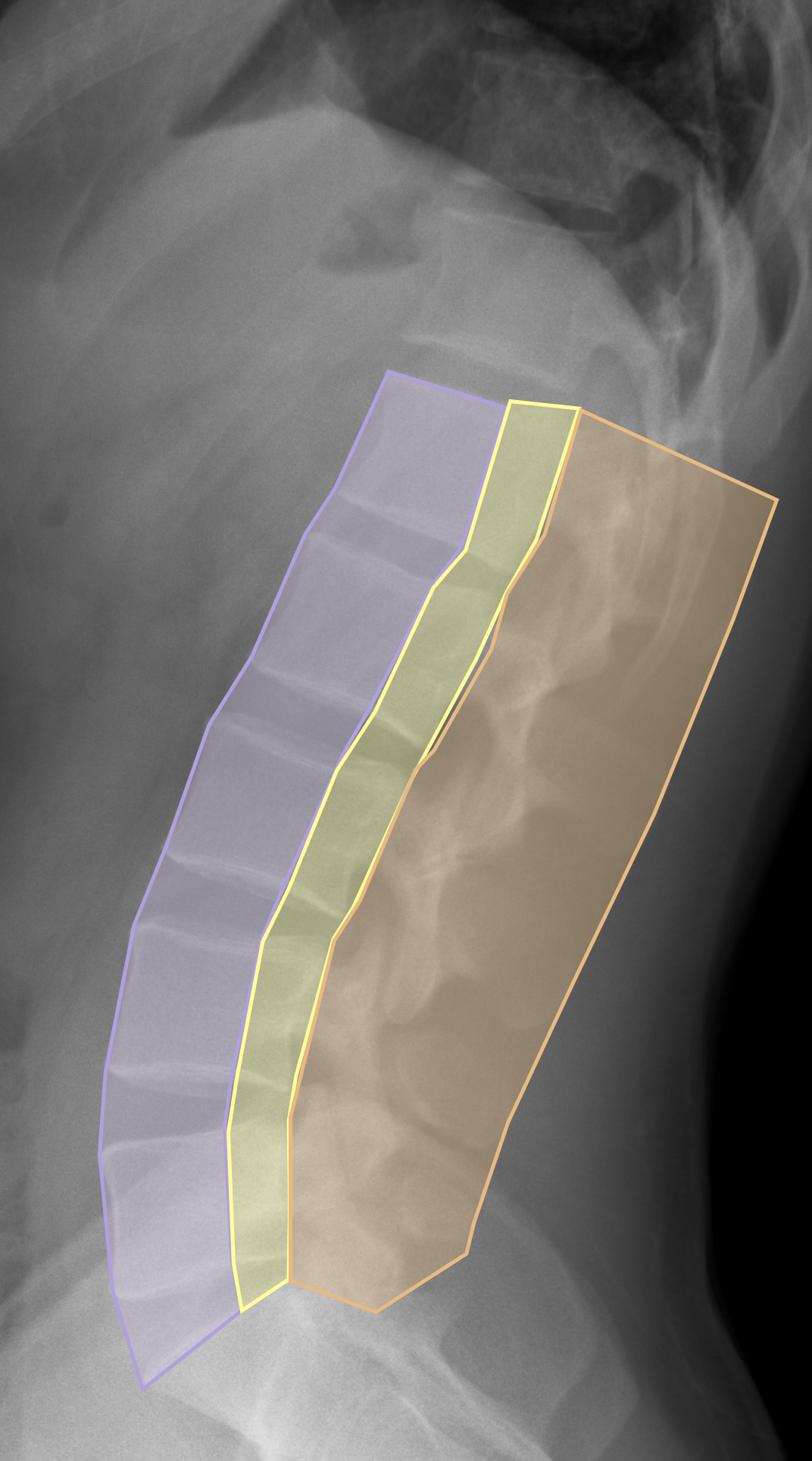 lspinetrauma2