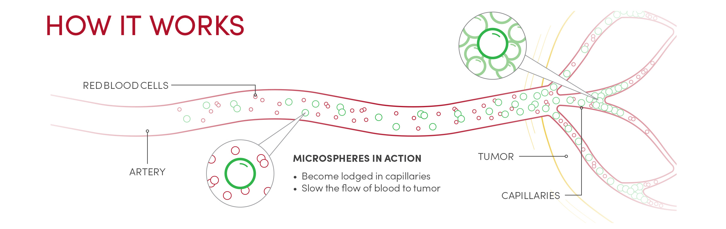 microspheres-in-action