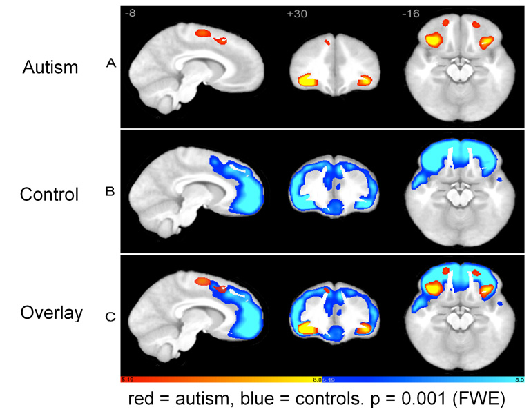 Autism vs control