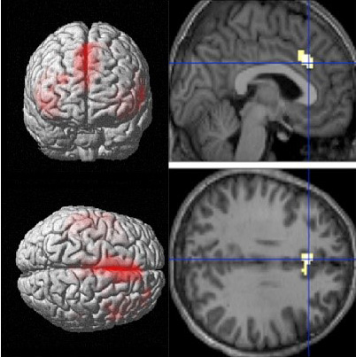 fMRI