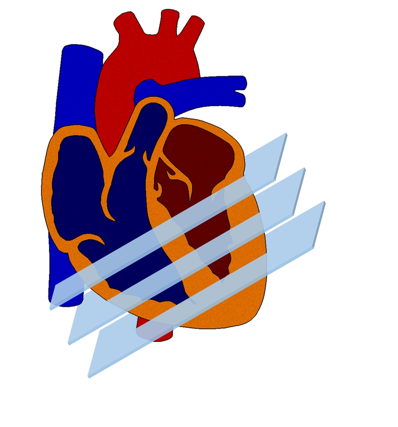 multisliceheart_thinslice8.jpg