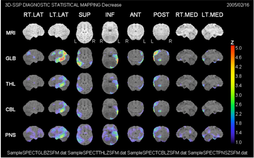 neurostat-example.jpg