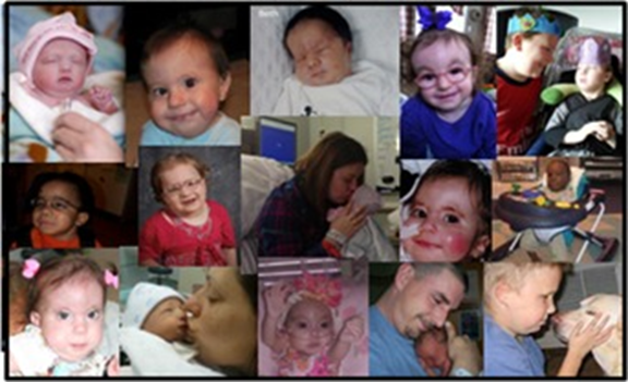Trisomy 13/18 children collage